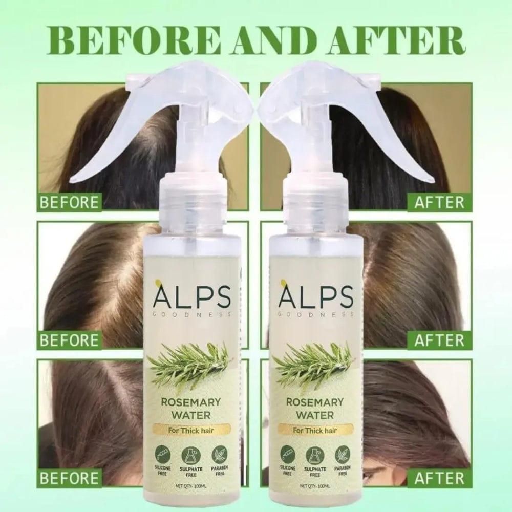 Alps Rosemary Water, Hair Spray For Regrowth super saver pack of 3
