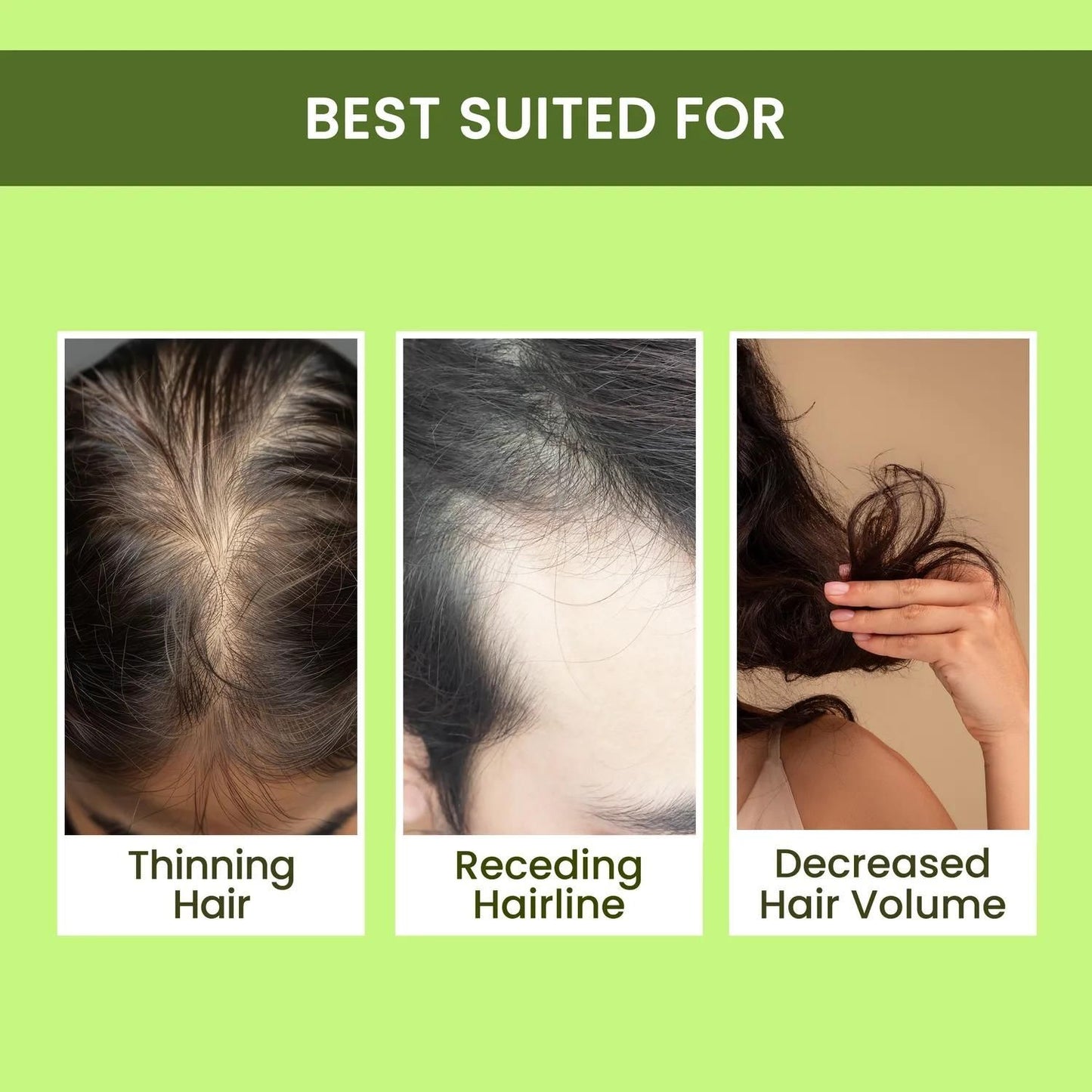 Alps Rosemary Water, Hair Spray For Regrowth super saver pack of 3